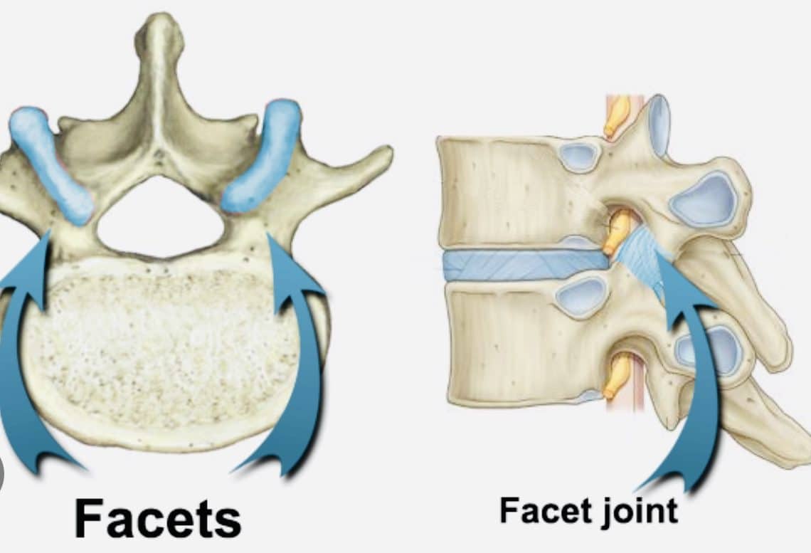 What Is Facet Joint Pain? - The Cause and The Effect