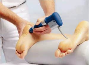 Visualization of shockwave therapy for Plantar Fasciitis treatment.
