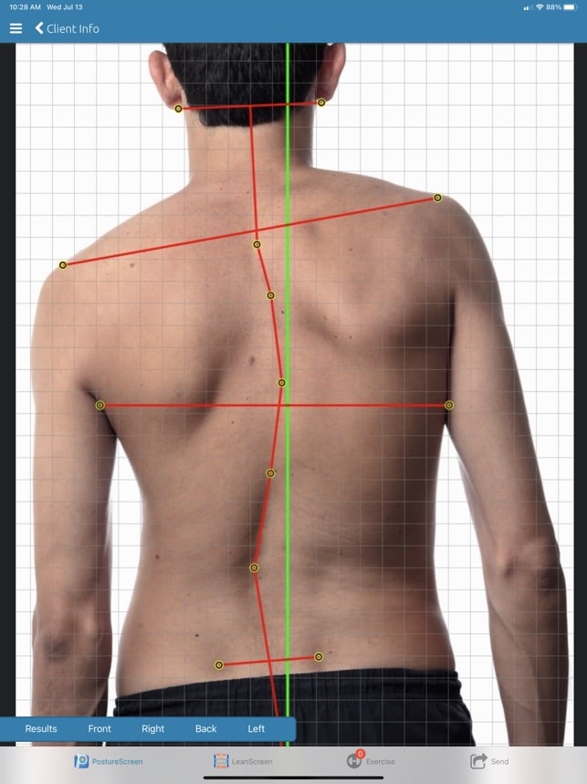 posture compensation using the posture analysis scan